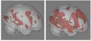 cerebellum