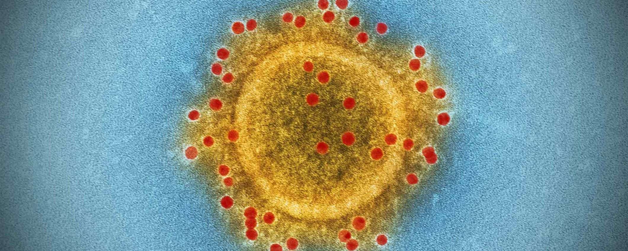 Coronavirus, le parole sono importanti: pandemia