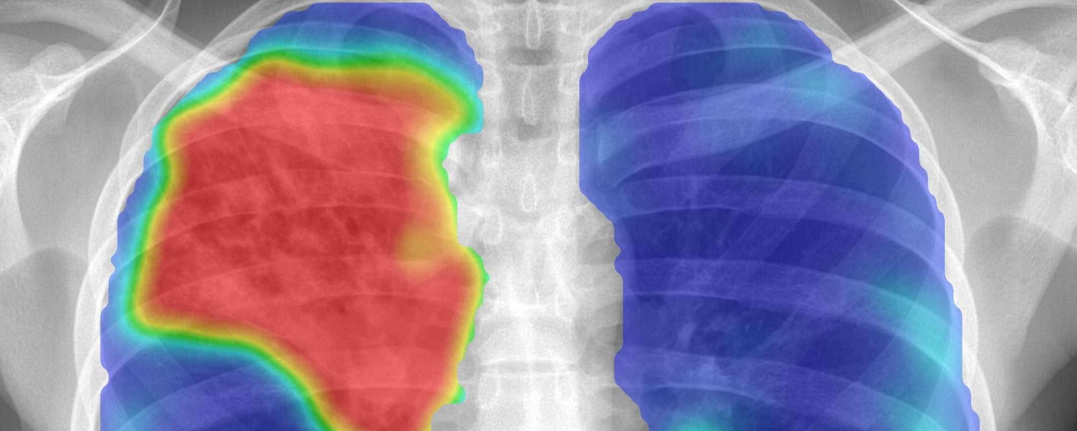 Tra 10 anni, i reparti di patologia saranno digitalizzati