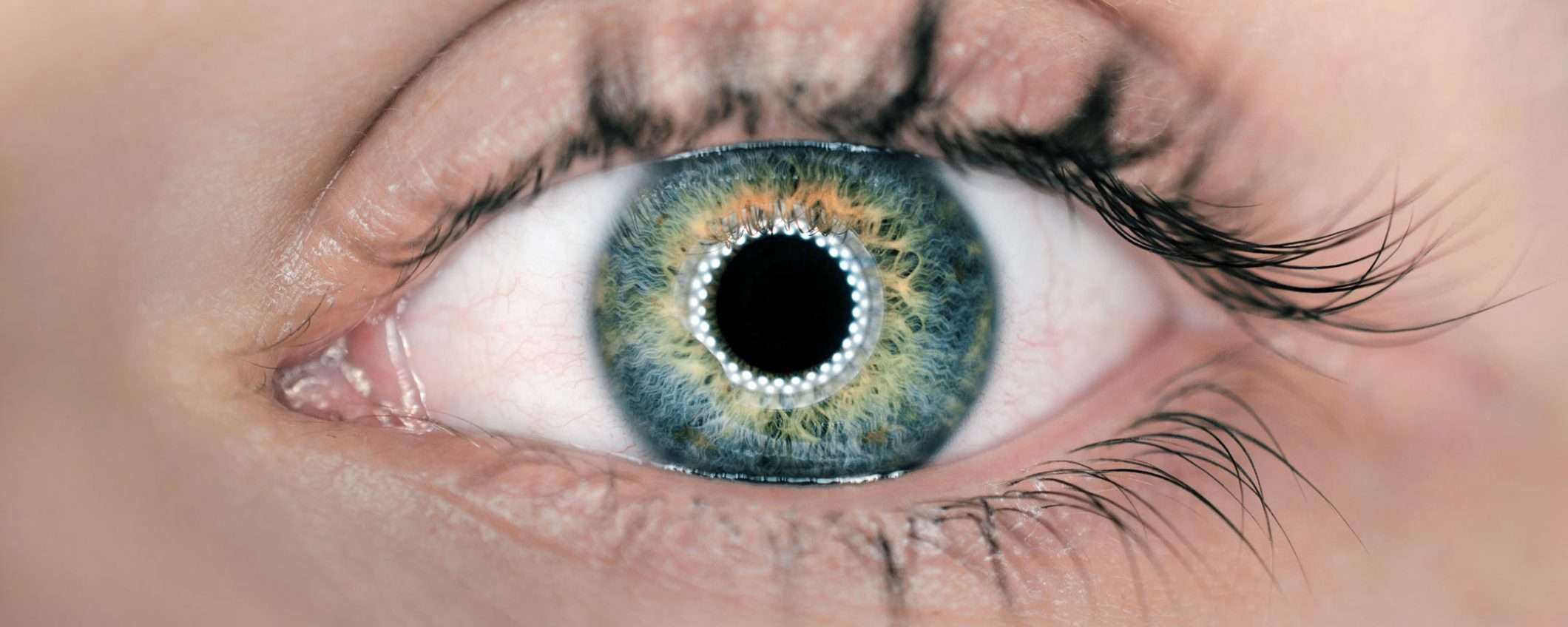 Torna a vedere grazie alla cornea artificiale