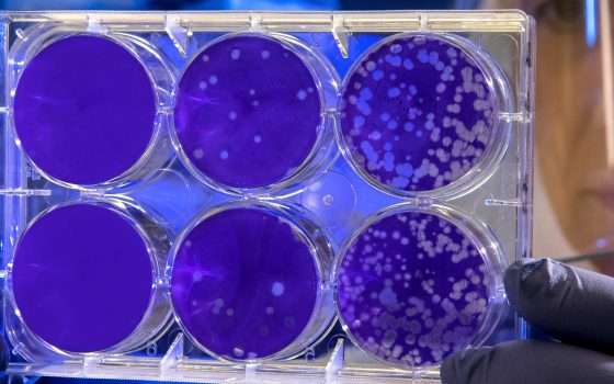 Scienziati scoprono nuovi antibiotici grazie all'AI