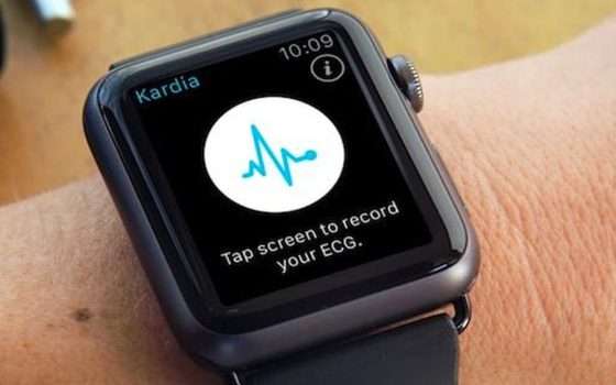 ECG con watchOS: Apple vince contro AliveCor